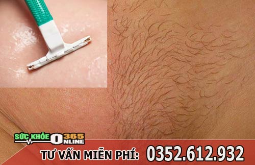 Phụ nữ có nên cạo lông ở vùng kín không?