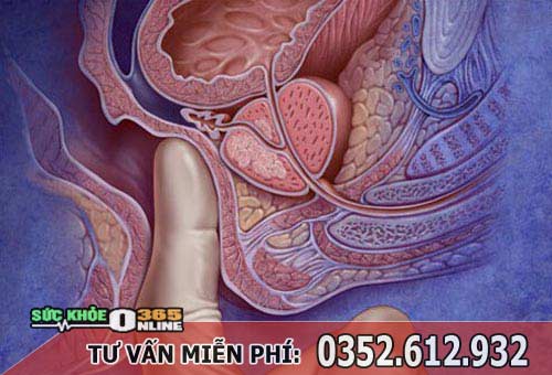 Điều trị viêm tuyến tiền liệt