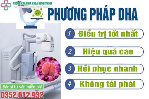 Kỹ thuật DHA