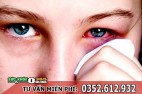 Bệnh lậu ở mắt: Nguyên nhân, biểu hiện, hình ảnh, cách chữa