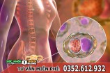 Bệnh lậu có gây vô sinh, ảnh hưởng đến sinh sản không?
