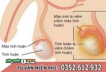 Viêm tinh hoàn: Nguyên nhân, triệu chứng, cách điều trị