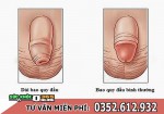Dài bao quy đầu có ảnh hưởng gì không, nên cắt không?