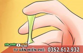 Ra khí hư màu xanh là dấu hiệu bệnh gì, cách chữa