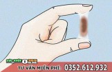 Ra khí hư màu nâu đen không mùi không ngứa là bệnh gì, cách chữa