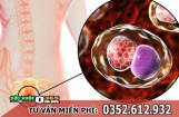 Thời gian ủ bệnh lậu ở nam, nữ giới là bao lâu?